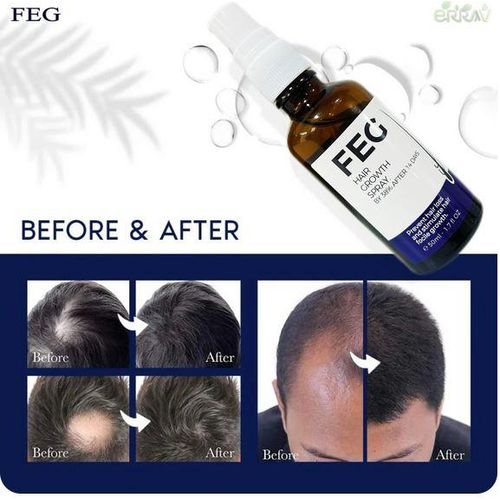 FEG Hair Growth Spray | Anti Hair Loss Treatment For Men & Women | Natural Herbal Formula
